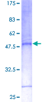 12.5% SDS-PAGE Stained with Coomassie Blue.